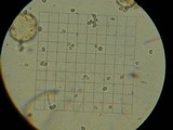 Cystoderma amianthinum image