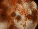 Scleroderma areolatum image