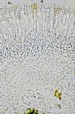 Lecanora carpinea image