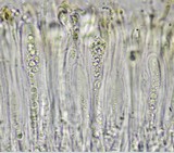 Lecanora carpinea image
