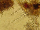 Tubulicrinis sororius image