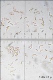 Tectella patellaris image