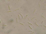 Tapesia fusca image
