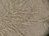 Neonectria fuckeliana image