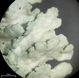 Heterodermia albicans image