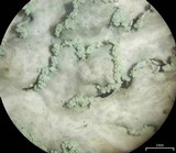 Heterodermia albicans image