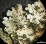 Heterodermia albicans image