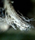 Graphiola phoenicis image