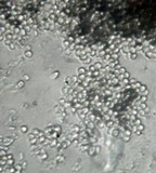 Graphiola phoenicis image