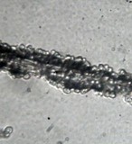 Graphiola phoenicis image