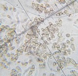 Lichenodiplis lecanorae image
