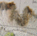 Lichenodiplis lecanorae image