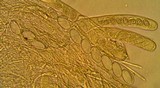 Geopyxis vulcanalis image