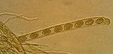 Geopyxis vulcanalis image