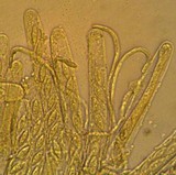 Byssonectria fusispora image
