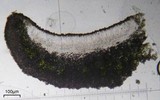 Lecanora caesiorubella image