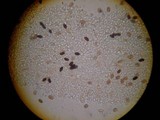 Parasola conopilea image