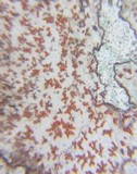 Arthonia rubrocincta image