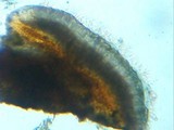 Buellia triseptata image