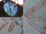 Pertusaria heterochroa image