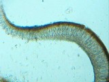 Collema polycarpon image