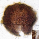 Lichenostigma saxicola image