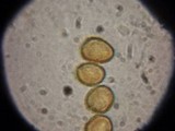 Metatrichia vesparium image