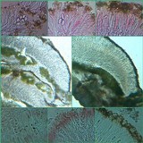 Caloplaca holocarpa image