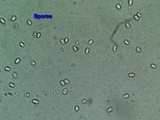 Pluteus petasatus image