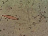 Inocybe bresadolae image
