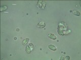 Amanita elliptosperma image