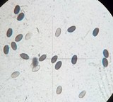 Psathyrella bipellis image