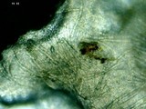 Pseudoplectania melaena image