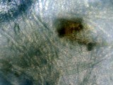 Pseudoplectania melaena image