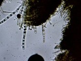 Pseudoplectania melaena image