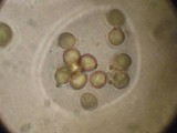 Calvatia pachyderma image
