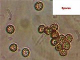 Geastrum nanum image