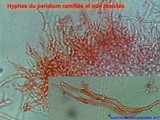 Scleroderma verrucosum image