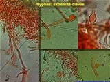 Scleroderma verrucosum image