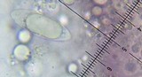 Peziza gerardii image