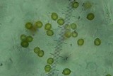 Melanoleuca subpulverulenta image