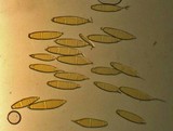 Bactridium flavum image