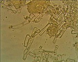 Bactridium flavum image