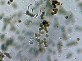 Lycoperdon umbrinum image