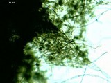 Lycoperdon umbrinum image