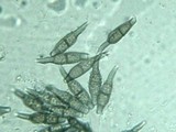 Spiropes melanoplaca image