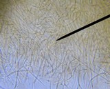Dacryopinax spathularia image