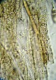 Entoloma bipellis image
