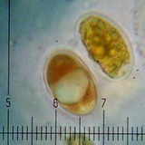 Verrucaria macrostoma f. macrostoma image