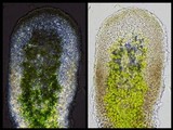 Pertusaria coccodes image